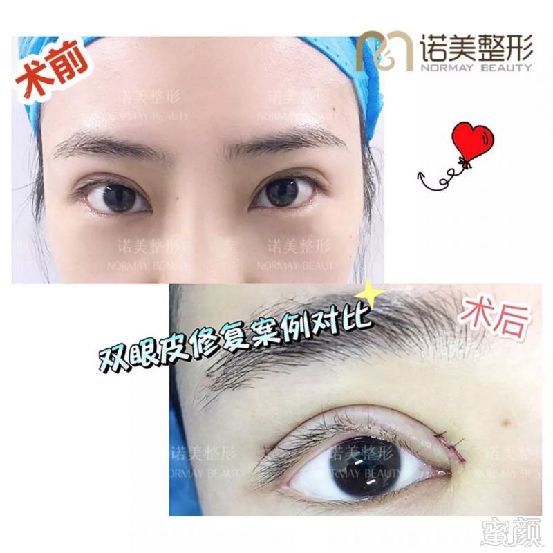 案例图片