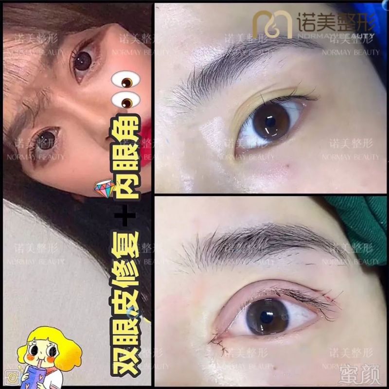 案例图片