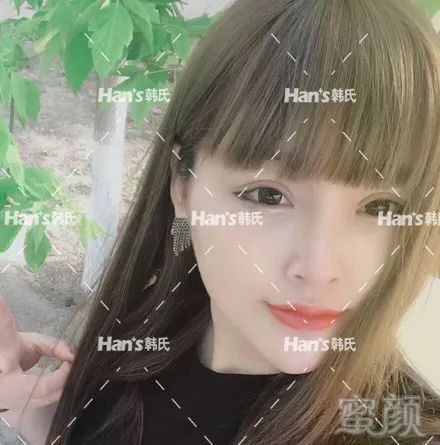 https://img.miyanlife.com/mnt/timg/190227/13495SR7-6.jpg 案例图片