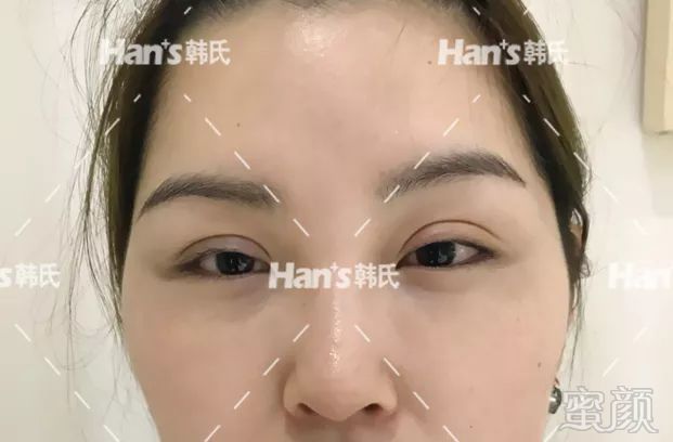 https://img.miyanlife.com/mnt/timg/190227/13495TS2-5.jpg 案例图片