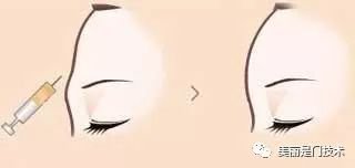 https://img.miyanlife.com/mnt/timg/190227/14015A262-2.jpg