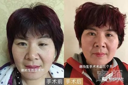 案例图片