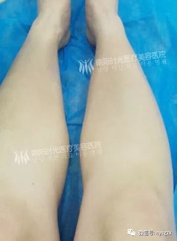 https://img.miyanlife.com/mnt/timg/190228/1220351396-6.jpg
