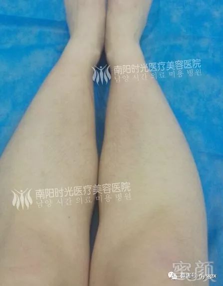 https://img.miyanlife.com/mnt/timg/190228/1220352545-5.jpg