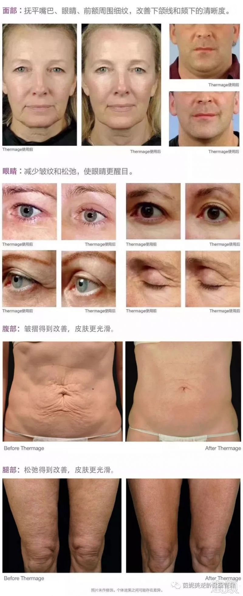 https://img.miyanlife.com/mnt/timg/190228/1229304N6-8.jpg