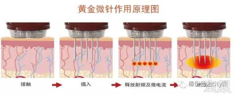 案例图片