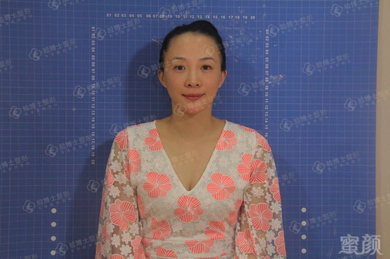 https://img.miyanlife.com/mnt/timg/190228/12353LW4-5.jpg