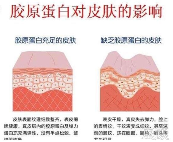 https://img.miyanlife.com/mnt/timg/190228/12492933S-1.jpg