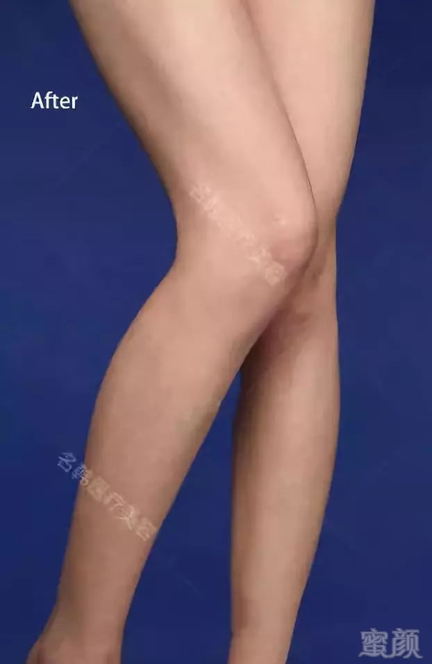 https://img.miyanlife.com/mnt/timg/190228/1250362A5-13.jpg
