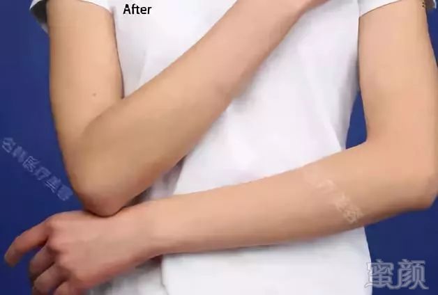https://img.miyanlife.com/mnt/timg/190228/1250363951-12.jpg