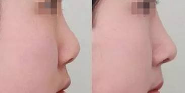 https://img.miyanlife.com/mnt/timg/190228/14002639C-2.jpg