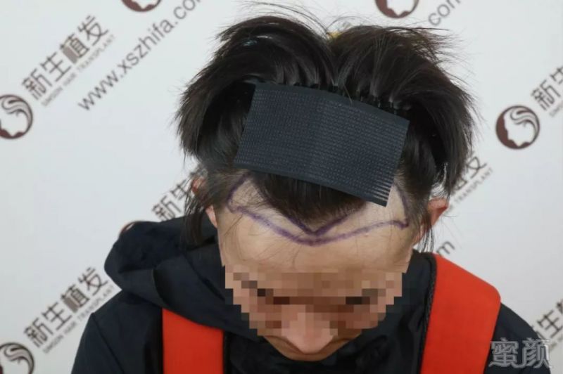 https://img.miyanlife.com/mnt/timg/190228/14023C257-1.jpg