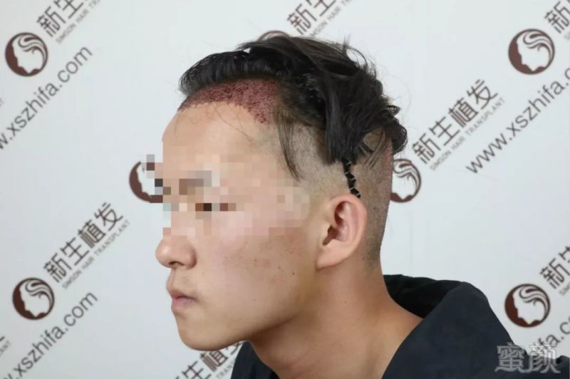 https://img.miyanlife.com/mnt/timg/190228/1402413M3-5.jpg
