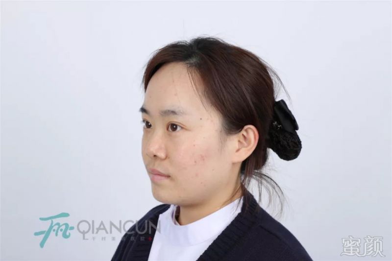 https://img.miyanlife.com/mnt/timg/190301/125K12501-1.jpg