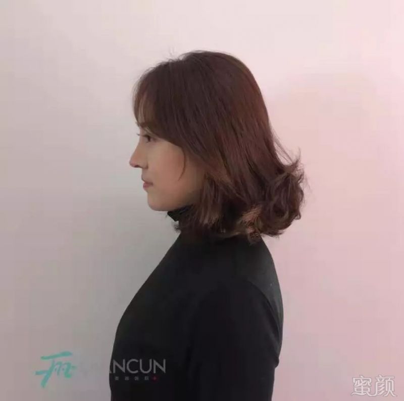 https://img.miyanlife.com/mnt/timg/190301/125K3C62-8.jpg