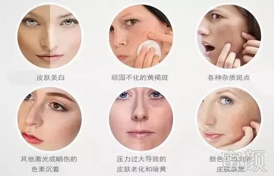 https://img.miyanlife.com/mnt/timg/190301/125U43V7-2.jpg