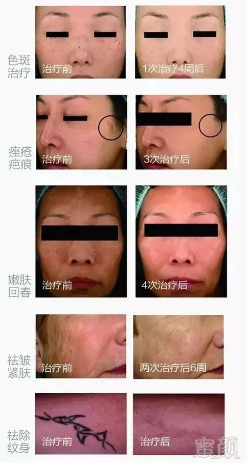 https://img.miyanlife.com/mnt/timg/190301/125UUC3-4.jpg