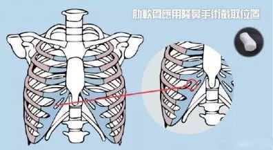 案例图片