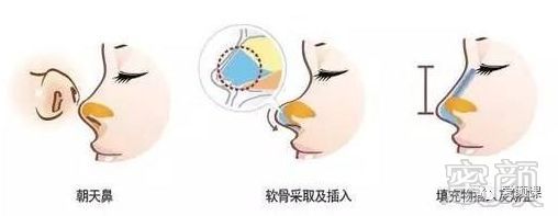 https://img.miyanlife.com/mnt/timg/190301/1354224V9-2.jpg