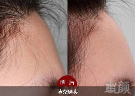 https://img.miyanlife.com/mnt/timg/190301/1416233038-9.jpg