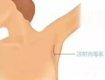 https://img.miyanlife.com/mnt/timg/190301/14202441P-5.jpg