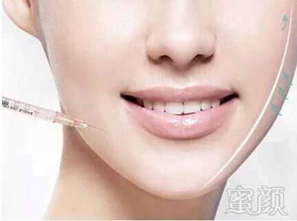 https://img.miyanlife.com/mnt/timg/190301/14202461H-1.jpg