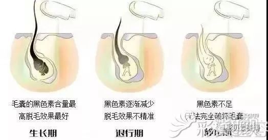 https://img.miyanlife.com/mnt/timg/190301/1424524L8-1.jpg