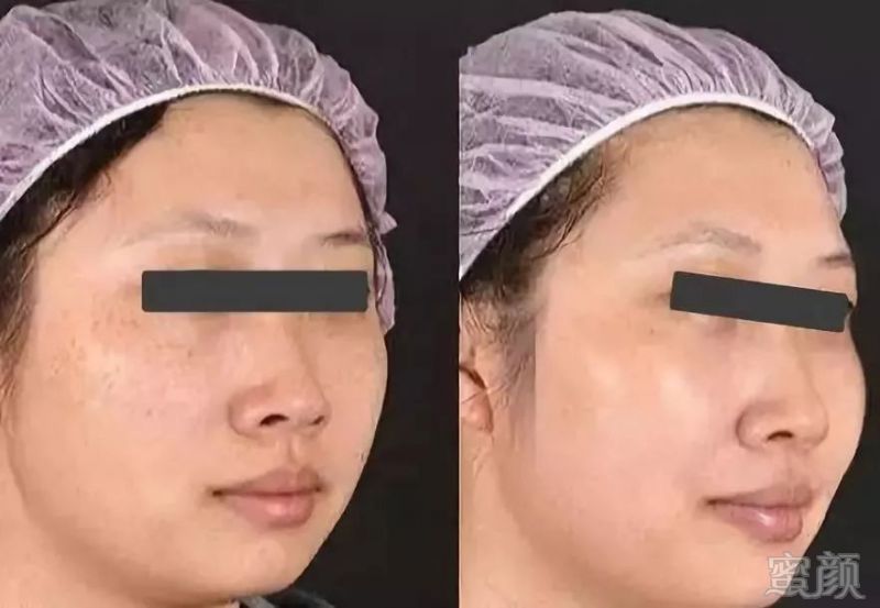 https://img.miyanlife.com/mnt/timg/190301/1433553922-1.jpg
