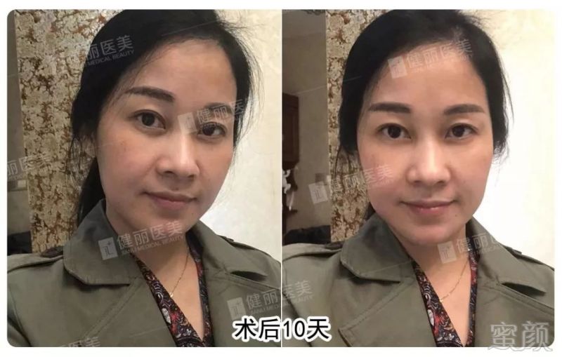 https://img.miyanlife.com/mnt/timg/190301/14361H603-7.jpg