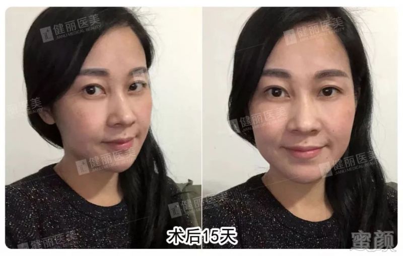 https://img.miyanlife.com/mnt/timg/190301/14361LO2-8.jpg