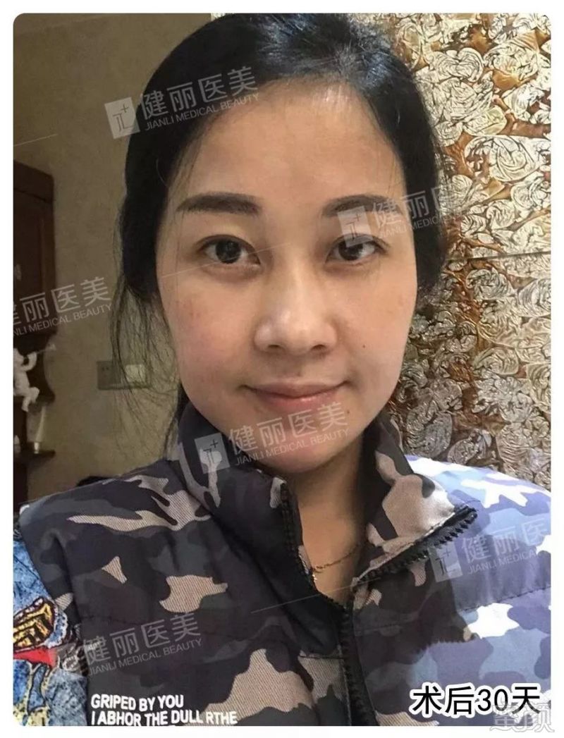 https://img.miyanlife.com/mnt/timg/190301/14361Q5R-9.jpg