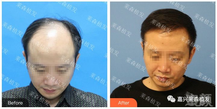 https://img.miyanlife.com/mnt/timg/190302/124TH115-0.jpg