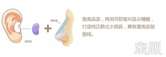 https://img.miyanlife.com/mnt/timg/190302/12591461F-6.jpg
