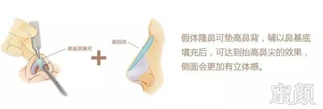 https://img.miyanlife.com/mnt/timg/190302/1259146392-9.jpg