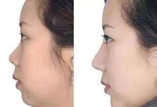 https://img.miyanlife.com/mnt/timg/190302/12591463J-8.jpg