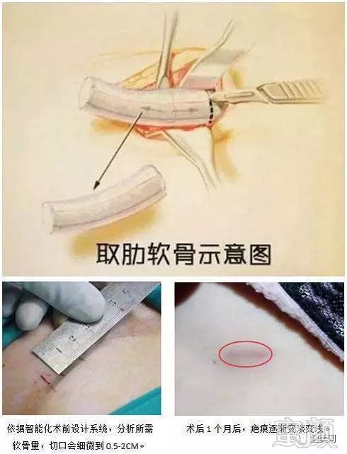 https://img.miyanlife.com/mnt/timg/190302/13203M160-7.jpg
