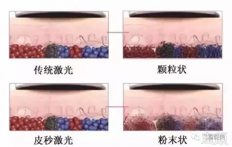 https://img.miyanlife.com/mnt/timg/190302/14060910K-3.jpg