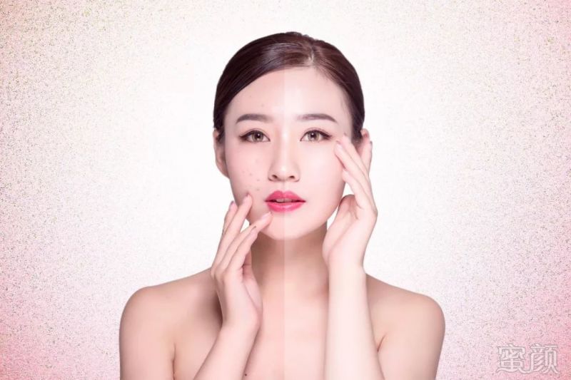 https://img.miyanlife.com/mnt/timg/190302/1409323012-1.jpg