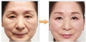 https://img.miyanlife.com/mnt/timg/190303/112Z61493-5.jpg