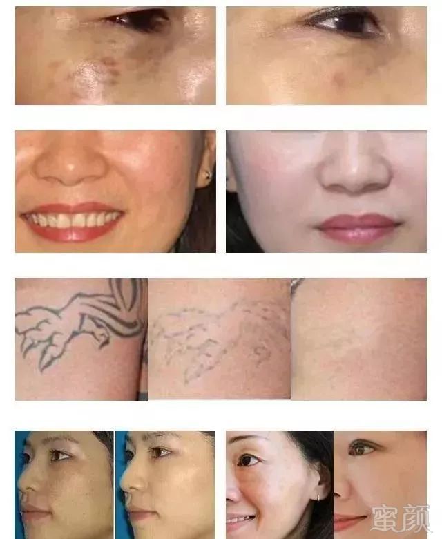 https://img.miyanlife.com/mnt/timg/190303/11512T935-14.jpg