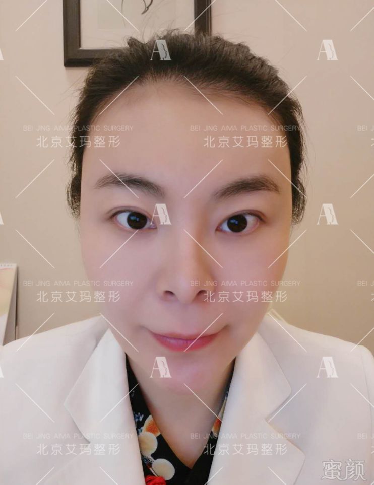 https://img.miyanlife.com/mnt/timg/190303/1233392403-3.jpg
