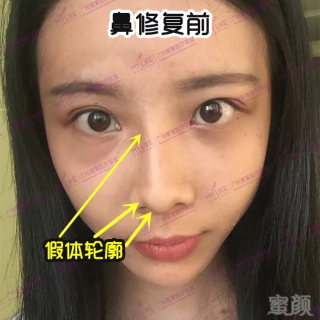 https://img.miyanlife.com/mnt/timg/190303/1249234961-4.jpg