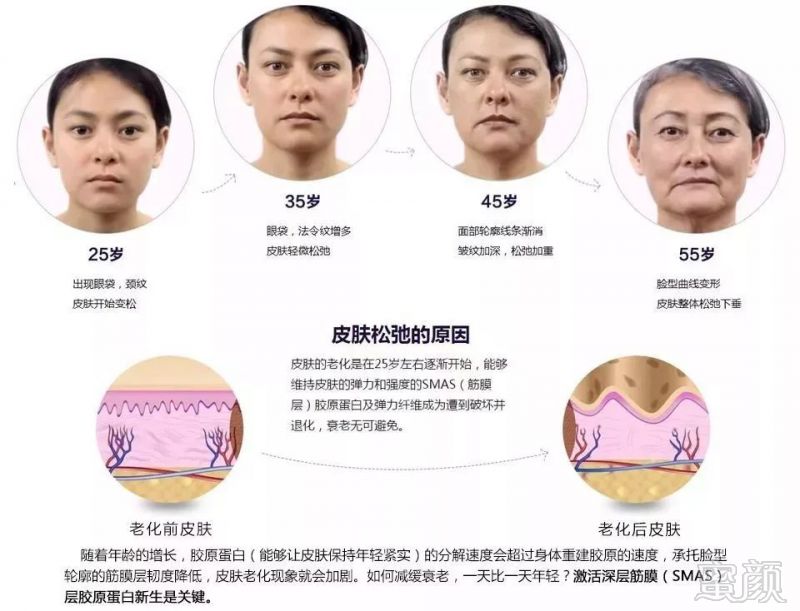 https://img.miyanlife.com/mnt/timg/190303/124A5H19-1.jpg