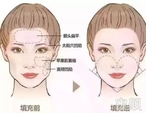 https://img.miyanlife.com/mnt/timg/190303/13055642U-1.jpg