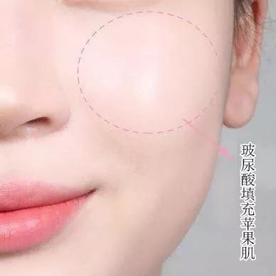 https://img.miyanlife.com/mnt/timg/190303/13055B536-5.jpg