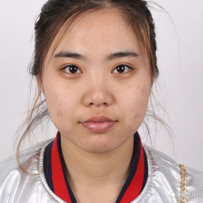 案例图片