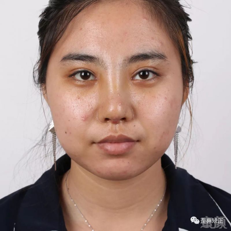 案例图片