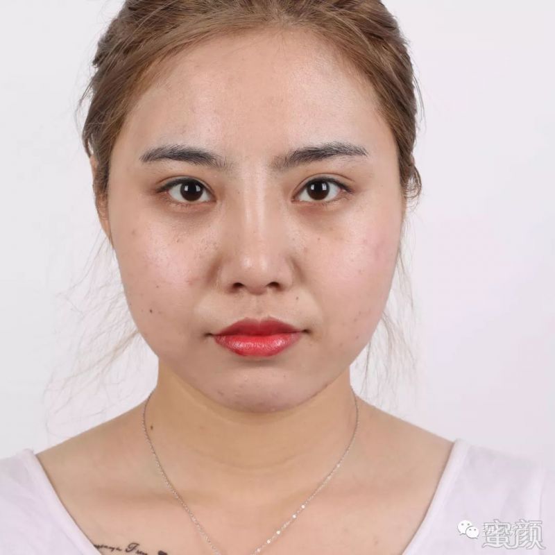 案例图片
