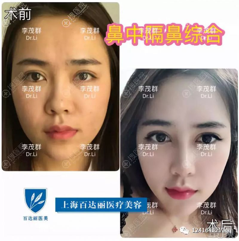 https://img.miyanlife.com/mnt/timg/190304/124I121E-1.jpg