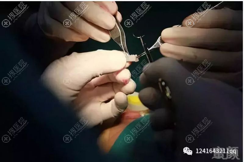 https://img.miyanlife.com/mnt/timg/190304/124I2C17-4.jpg